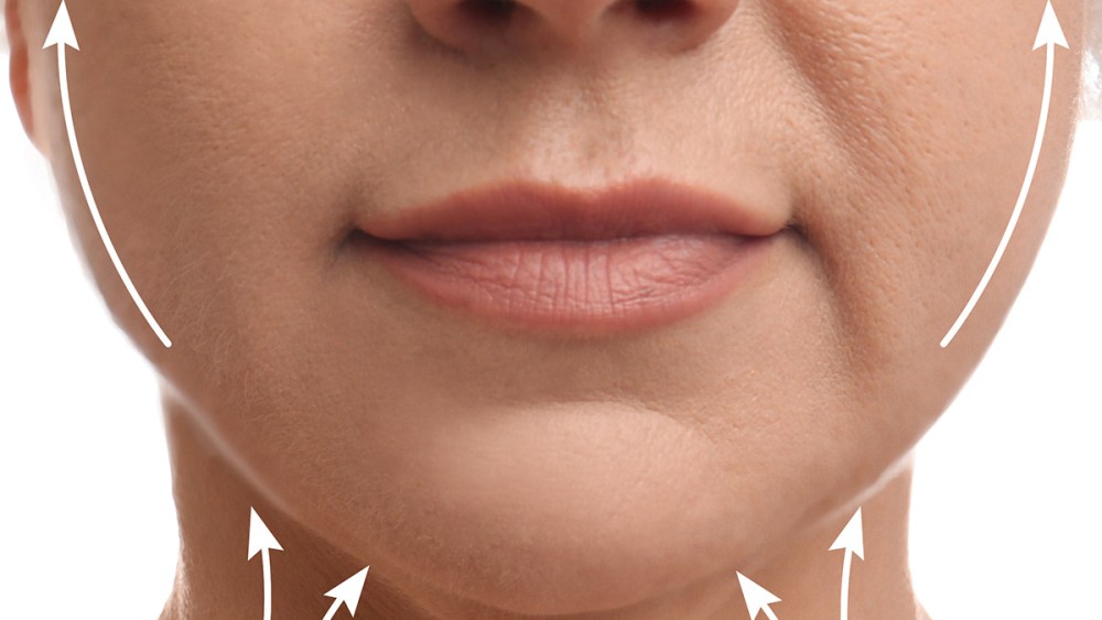Mature woman before and after plastic surgery operation on white background, closeup. Double chin problem