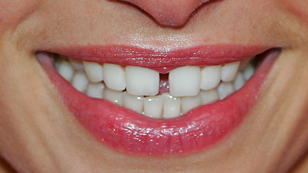 The teeth of Supermodel Jess Hart are seen as she smiles at the Myer marquee during Crown Oaks Day at Flemington Racecourse on November 4, 2010 in Melbourne, Australia.